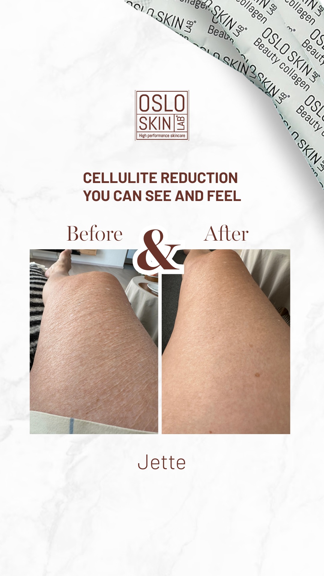 Oslo Skin Lab ad