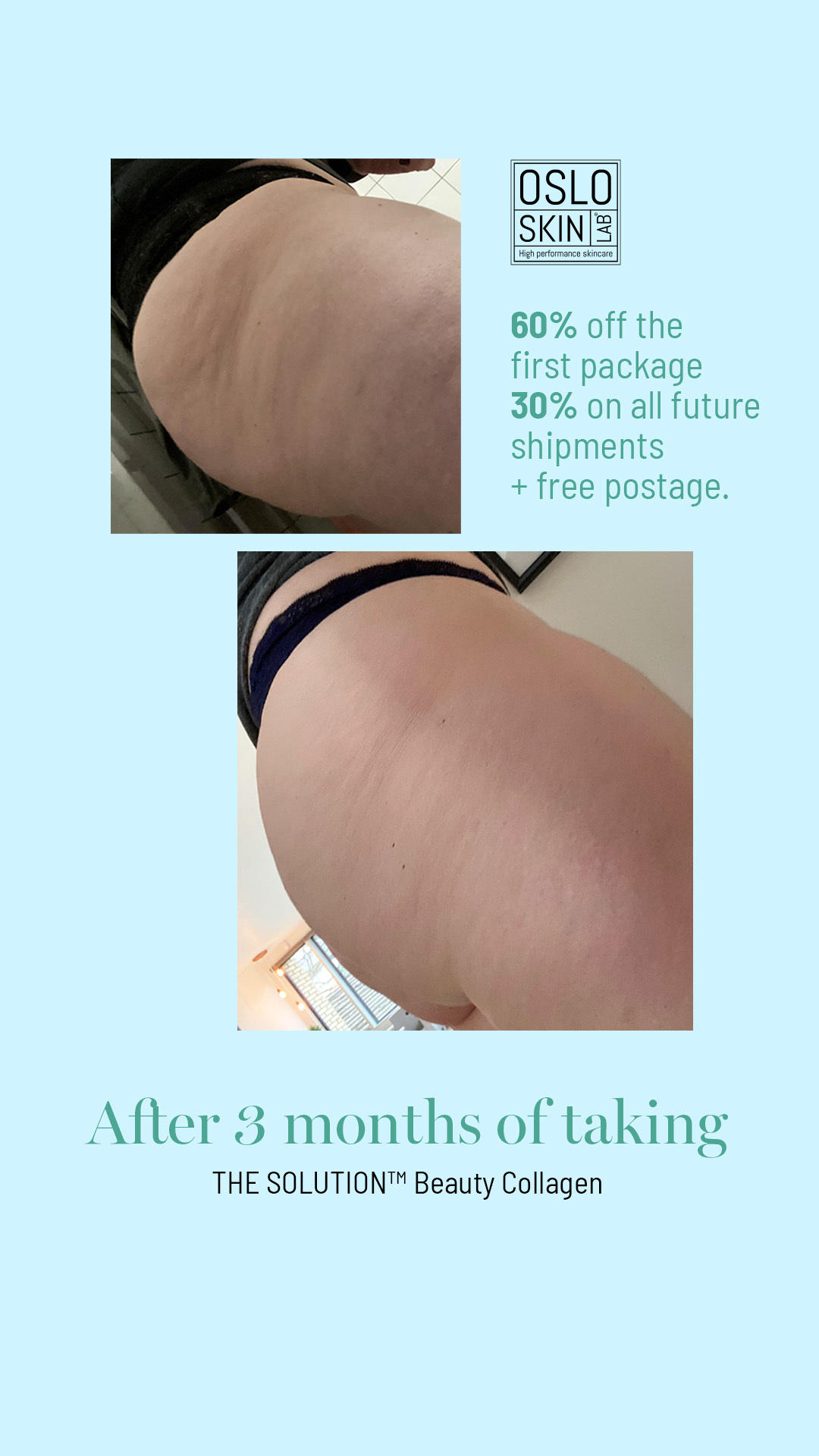 Oslo Skin Lab ad
