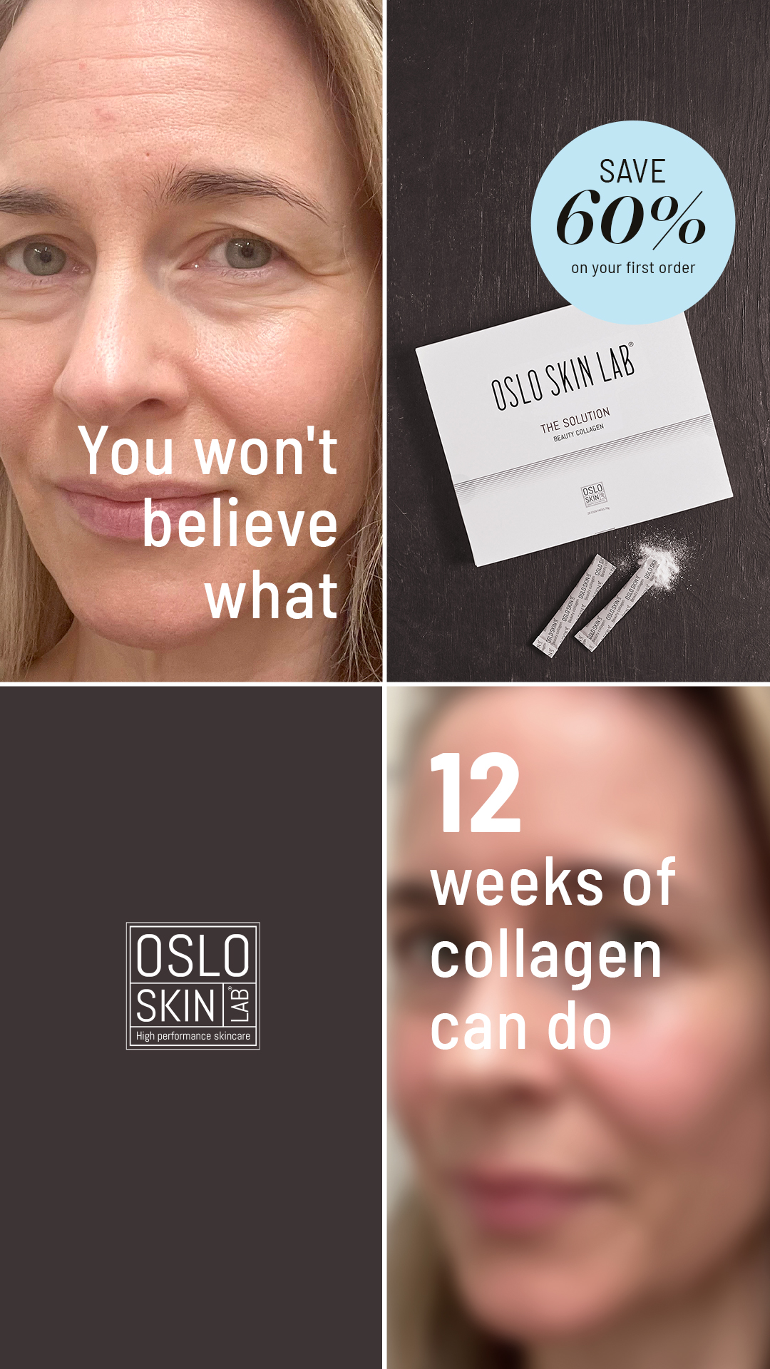 Oslo Skin Lab ad