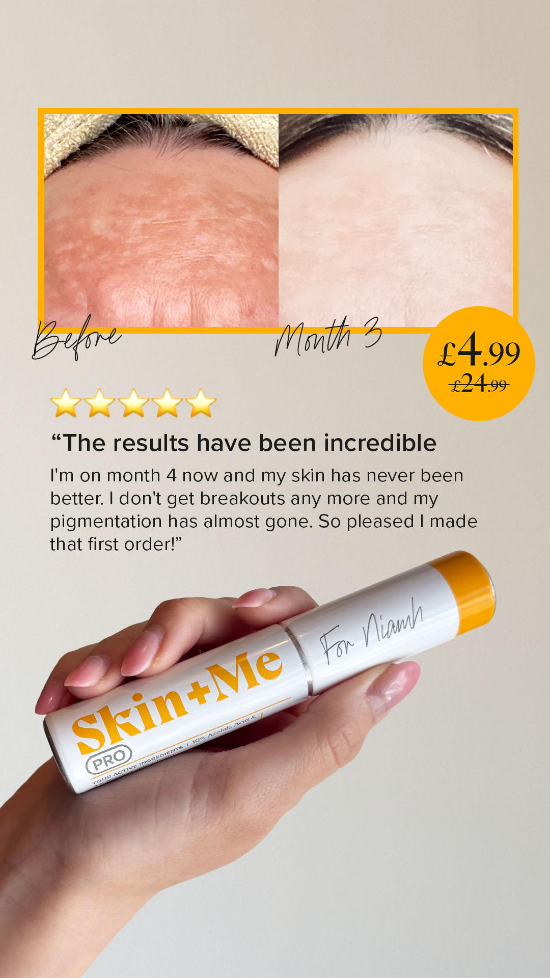 Skin + Me ad